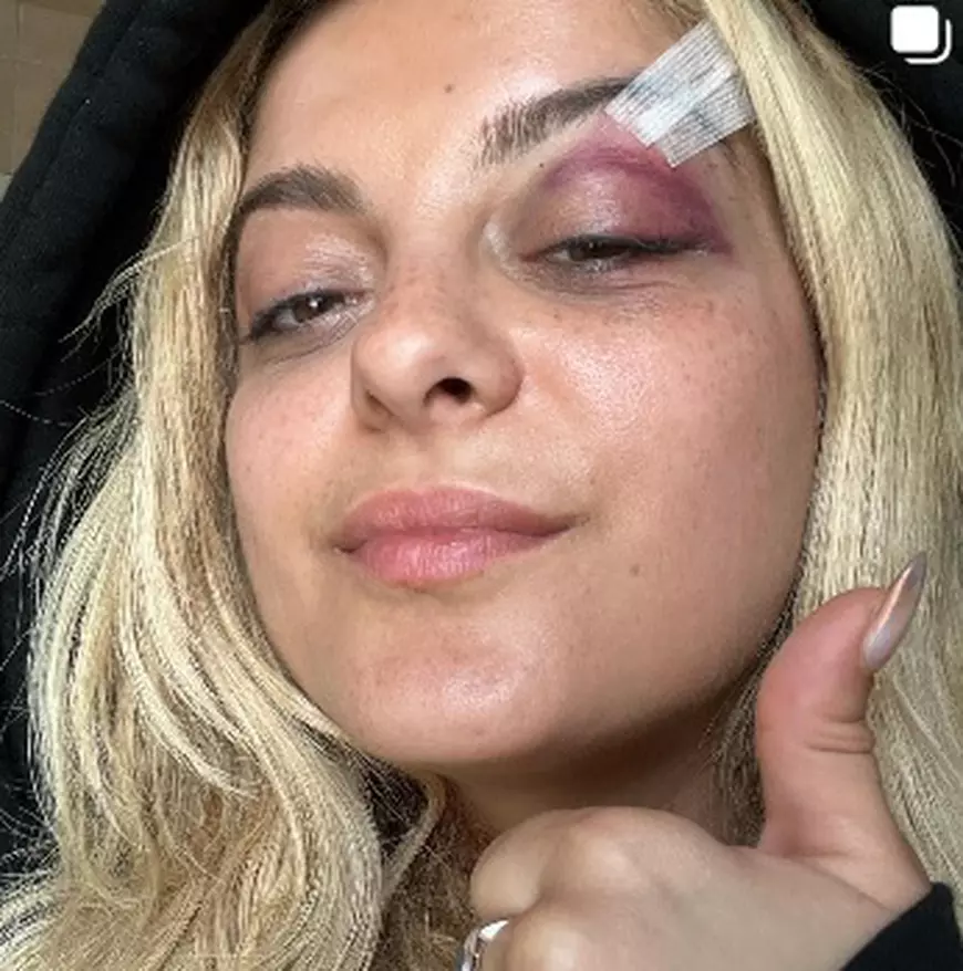 Bebe Rexha s-a prăbușit pe scenă după ce a fost lovită cu un telefon în cap în timpul unui concert. Incidentul a fost filmat
