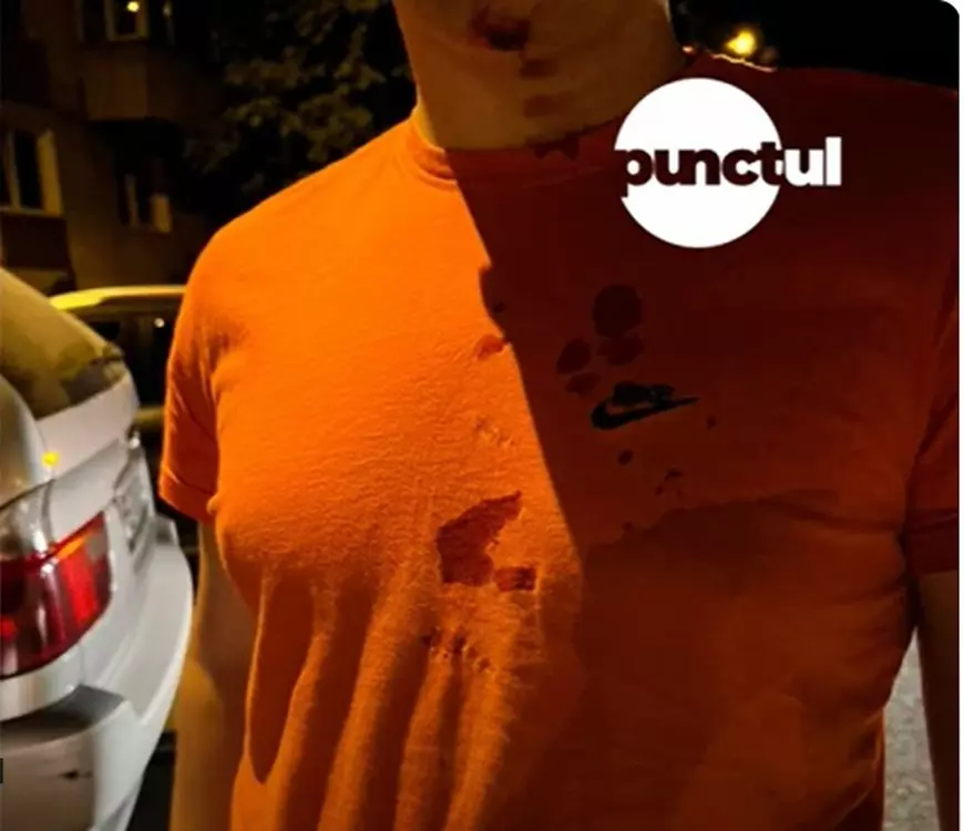 Polițiști din Mureș, acuzați cu au bătut un adolescent de 17 ani. „Mi-a dat un pumn în ficat”